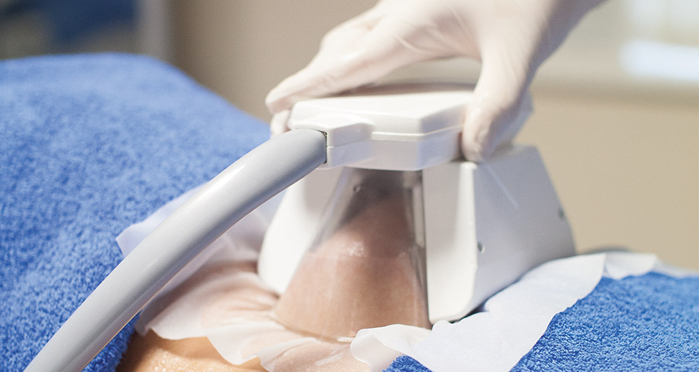 How Fat Freezing and HIFU Work Together? 2 Multiple Areas in One Session HIFU and Fat Freezing Purfleet